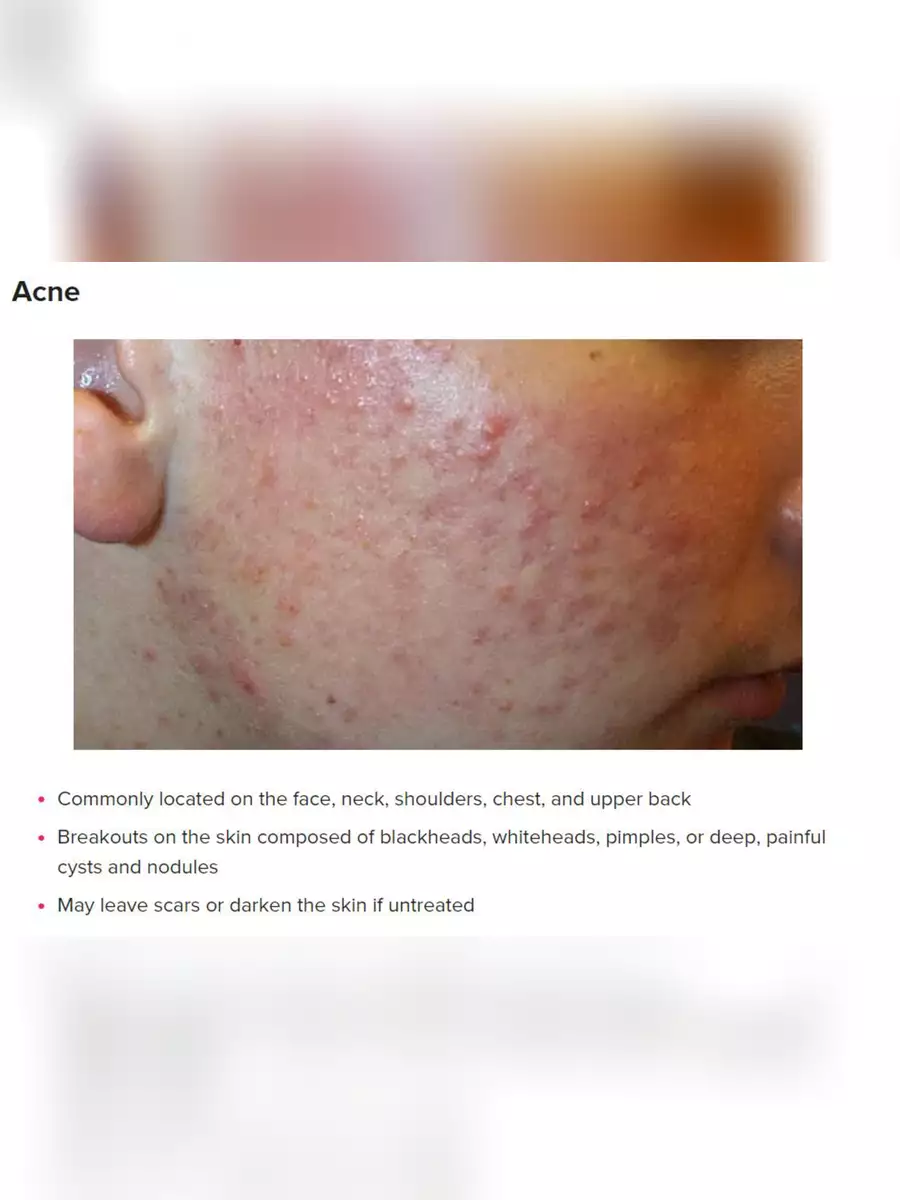 2nd Page of Skin Diseases List with Pictures PDF