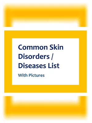 Skin Diseases List with Pictures
